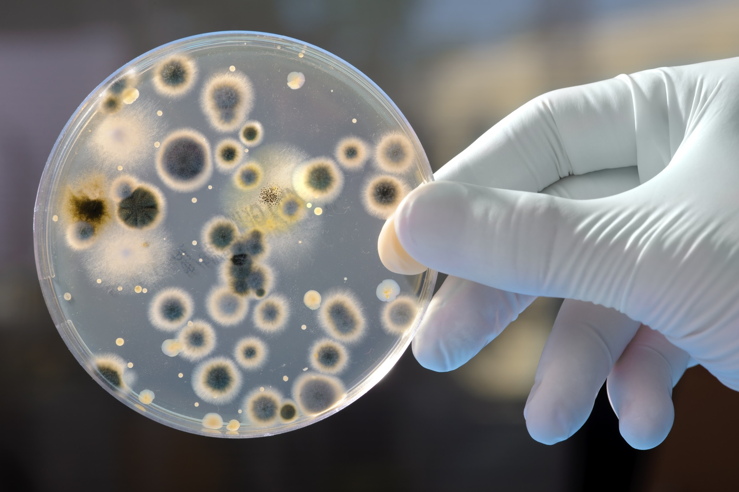 Cultura de Bactérias sobre Microbiologia